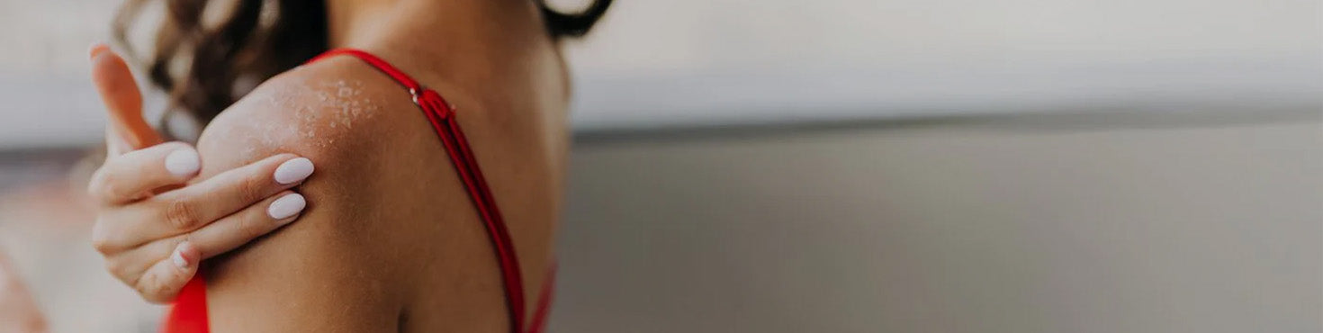 Immagine che raffigura una donna con pelle secca