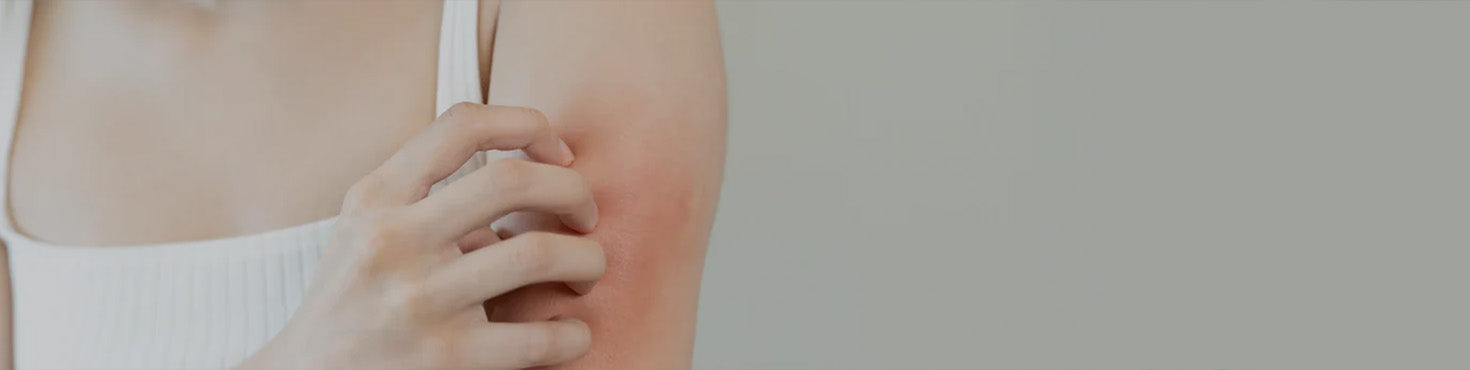 Immagine che raffigura una donna con pelle arrossata