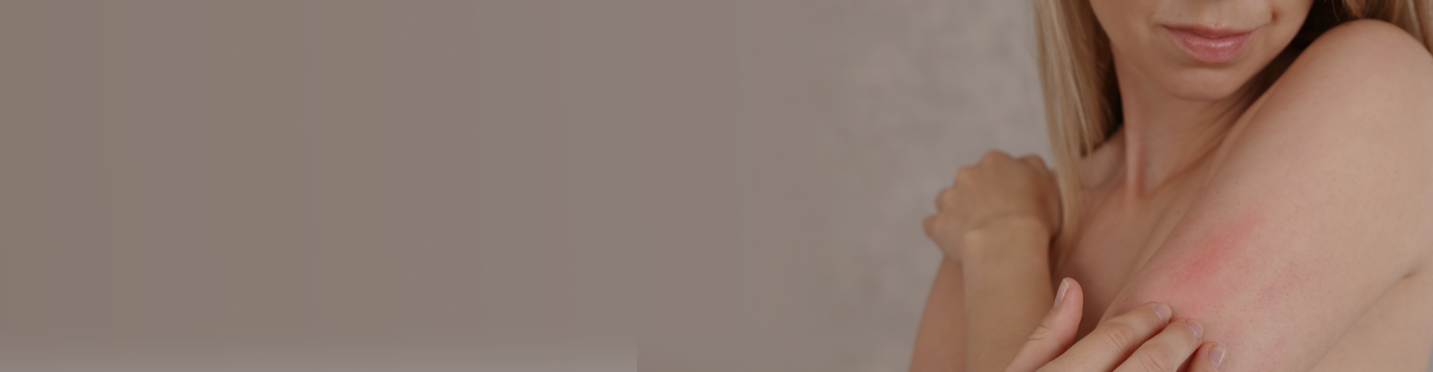 Infiammazioni cutanee