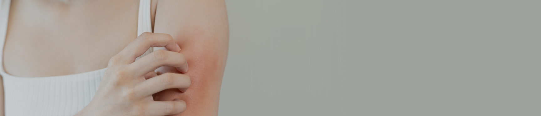 Irritazioni rossori e prurito