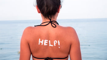 Immagine che raffigura una donna scottata dal sole
