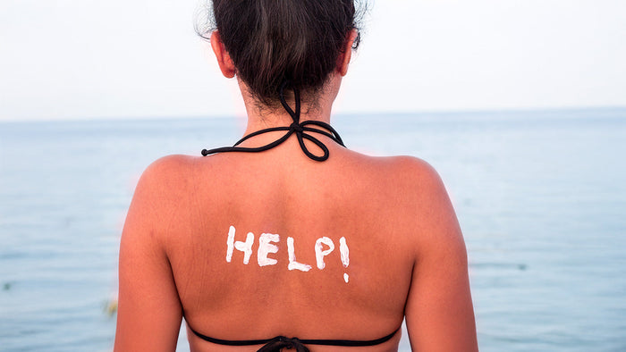 Immagine che raffigura una donna scottata dal sole