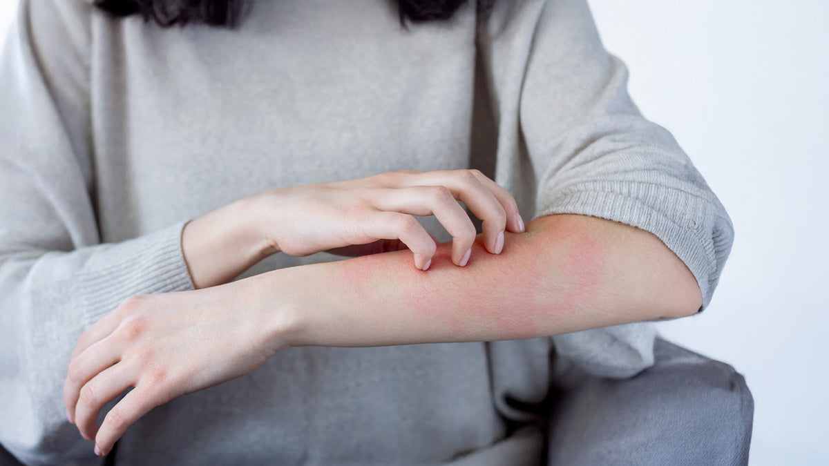 Immagine che raffigura una donna che si gratta