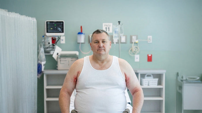 Immagine che rappresenta un uomo obeso con intertrigine